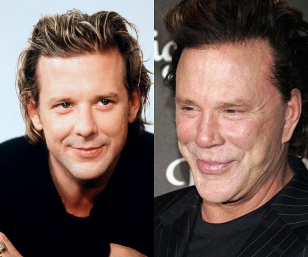 degats-chirurgie-esthetique-ratee-mickey-rourke